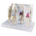 GPI Anatomicals - 4-Stage Canine Knee Model Set, Degenerative Joint Disease Models for Canine Anatomy and Physiology Education, Anatomy Model for Veterinarian’s Offices, Medical Learning Resources